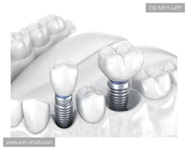 凯发集团客户端免费下载安装的注意事项，确保安装顺利无误，避免常见错误与风险